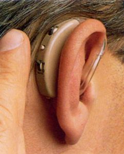 Слуховой Аппарат У 03 Купить